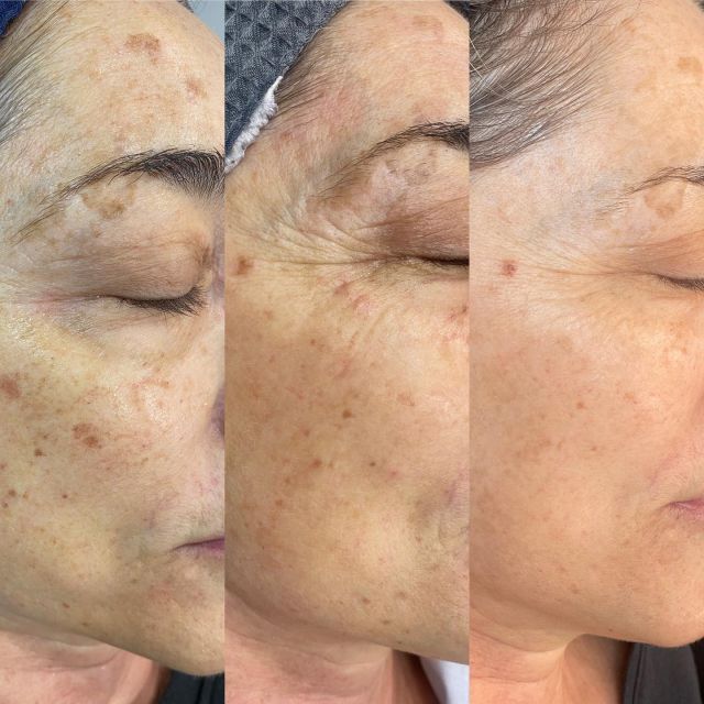 where can i get glutathione injection in abuja Locations